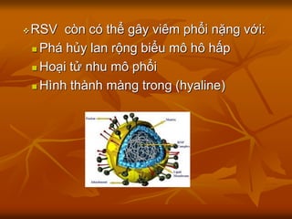 RSV còn có thể gây viêm phổi nặng với:
 Phá hủy lan rộng biểu mô hô hấp
 Hoại tử nhu mô phổi
 Hình thành màng trong (hyaline)
 