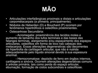 MÃO
• Articulações interfalângicas proximais e distais e articulações
carpometacarpais (a primeira, principalmente).
• Nódulos de Heberden (D) e Bouchard (P) ocorrem por
fenômenos hipertróficos e osteófitos proeminentes.
• Osteoartrose Secundária:
- Acromegalia: proeminência dos tecidos moles e
aumento de tamanho dos tufos terminais e das bases das
falanges terminas, alargamento e/ou espaçamento dos espaços
articulares, osteófitos em forma de bico nas cabeças dos
metacarpos. Essas alterações degenerativas são decorrentes
da hipertrofia da cartilagem articular, que não é nutrida
adequadamente pelo líquido sinovial devido à sua espessura
anormal.
- Hemocromatose: depósito de ferro em órgãos internos,
cartilagens e sinóvia. Ocorrem alterações degenerativas comuns
à artrose primária, tais como perda do espaço articular,
eburnação, formação de cistos subcondrais e osteofitose.
 
