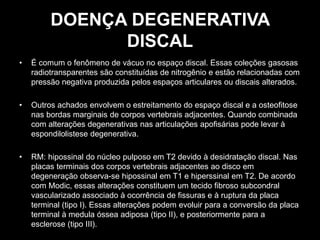 DOENÇA DEGENERATIVA
DISCAL
• É comum o fenômeno de vácuo no espaço discal. Essas coleções gasosas
radiotransparentes são constituídas de nitrogênio e estão relacionadas com
pressão negativa produzida pelos espaços articulares ou discais alterados.
• Outros achados envolvem o estreitamento do espaço discal e a osteofitose
nas bordas marginais de corpos vertebrais adjacentes. Quando combinada
com alterações degenerativas nas articulações apofisárias pode levar à
espondilolistese degenerativa.
• RM: hipossinal do núcleo pulposo em T2 devido à desidratação discal. Nas
placas terminais dos corpos vertebrais adjacentes ao disco em
degeneração observa-se hipossinal em T1 e hiperssinal em T2. De acordo
com Modic, essas alterações constituem um tecido fibroso subcondral
vascularizado associado à ocorrência de fissuras e à ruptura da placa
terminal (tipo I). Essas alterações podem evoluir para a conversão da placa
terminal à medula óssea adiposa (tipo II), e posteriormente para a
esclerose (tipo III).
 