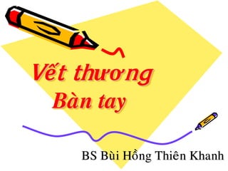 Vết thương
Baøn tay
BS Buøi Hoàng Thieân Khanh
 