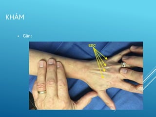 • Gân:
KHÁM
 