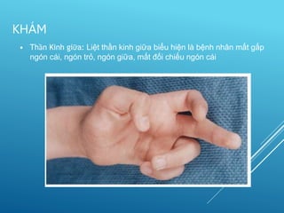 • Thần Kinh giữa: Liệt thần kinh giữa biểu hiện là bệnh nhân mất gấp
ngón cái, ngón trỏ, ngón giữa, mất đối chiếu ngón cái
KHÁM
 