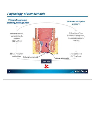 6 Phy si o lo g y o f Hemo rrh oi d s In crea sed in tra - pe lv ic p ress ure Dil at at io n o f t h e h e morrh o id al p le x us , i n crea sed p res su re , swel li ng L o cal s ero to n in (5 HT) re lea se 5 HT2 a re ce pt o r ac ti v at io n Effere nt v en o u s c on st ric ti on & p la te le t ag g re g at io n In te rn a l he mo rrh o id E x tern al h e mo rrh o id   VE N 3 0 9 Prima ry Sy mp to ms: B le ed in g , It ch i ng & Pa in
 