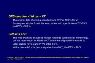 QRS duration >140 ms = VT
The original data showed a specificity and PPV of 100 % for VT
Subsequent studies found this less certain, with specificities of 57–75 %
and PPV of 89 %
Left axis = VT.
This was originally discussed without regard to bundle block morphology,
but it is most robust for RBBB WCT where the original PPV was 94 %.
Later studies have found PPVs of 88–94 %.
With extreme left axis (more negative than -90 °), the PPV is 98 %
Wellens HJ, Bar FW, Lie KI. The value of the electrocardiogram in the differential diagnosis of a tachycardia with a widened QRS complex.
Am J Med 1978;64:27–33
 
