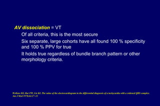 AV dissociation = VT
Of all criteria, this is the most secure
Six separate, large cohorts have all found 100 % specificity
and 100 % PPV for true
It holds true regardless of bundle branch pattern or other
morphology criteria.
Wellens HJ, Bar FW, Lie KI. The value of the electrocardiogram in the differential diagnosis of a tachycardia with a widened QRS complex.
Am J Med 1978;64:27–33
 