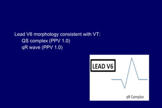 Lead V6 morphology consistent with VT:
QS complex (PPV 1.0)
qR wave (PPV 1.0)
 