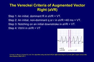 The Vereckei Criteria of Augmented Vector
Right (aVR)
Step 1: An initial, dominant R in aVR = VT.
Step 2: An initial, non-dominant q or r in aVR >40 ms = VT.
Step 3: Notching on an initial downstroke in aVR = VT.
Step 4: Vt≥Vi in aVR = VT
Vereckei A, Duray G, Szenasi G, et al. New algorithm using only lead aVR for differential diagnosis of wide QRS complex tachycardia.
Heart Rhythm 2008;5:89–9
 