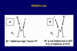 Rabbit’s ear
 