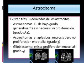 Astrocitoma
Existen tresTu derivados de los astrocitos:
 Astrocitomas:Tu de bajo grado,
generalmente sin necrosis, ni proliferación.
(grado 1º2).
 Astrocitomas anaplasicos: necrosis pero no
proliferacion endotelial (grado 3)
 Glioblastoma: existe proliferacion enotelial (
grado 4)
 