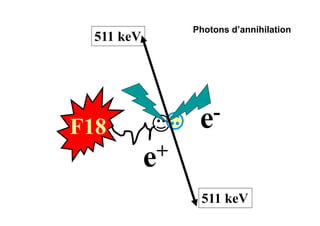 F18
e+
e-
511 keV
511 keV
Photons d’annihilation
 