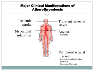 Major Clinical Manifestations of
Atherothrombosis
Transient ischemic
attack
Angina
• Unstable
Ischemic
stroke
Myocardial
infarction
Peripheral arterial
disease:
• Intermittent claudication
• Rest Pain
• Gangrene, Necrosis
 