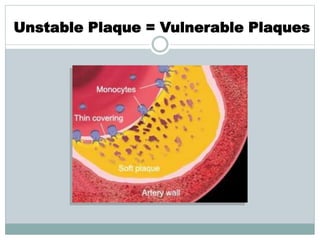 Unstable Plaque = Vulnerable Plaques
 