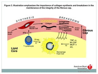 Figure 3. Illustration emphasizes the importance of collagen synthesis and breakdown in the
maintenance of the integrity of the fibrous cap.
 