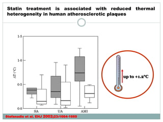 Stefanadis et al. EHJ 2002;23:1664-1669
Statin treatment is associated with reduced thermal
heterogeneity in human atherosclerotic plaques
up to +1.2°C
 