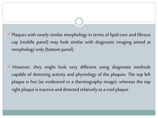 Plaques with nearly similar morphology in terms of lipid core and fibrous
cap (middle panel) may look similar with diagnostic imaging aimed at
morphology only (bottom panel).
 However, they might look very different using diagnostic methods
capable of detecting activity and physiology of the plaques. The top left
plaque is hot (as evidenced in a thermography image), whereas the top
right plaque is inactive anddetected relatively asa cool plaque.
 