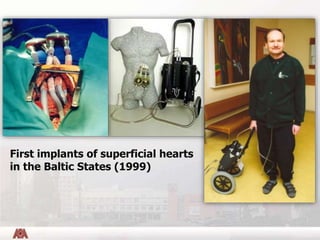 First implants of superficial hearts
in the Baltic States (1999)
 