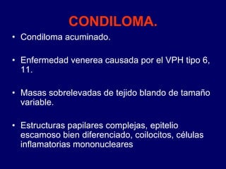 CONDILOMA.
• Condiloma acuminado.
• Enfermedad venerea causada por el VPH tipo 6,
11.
• Masas sobrelevadas de tejido blando de tamaño
variable.
• Estructuras papilares complejas, epitelio
escamoso bien diferenciado, coilocitos, células
inflamatorias mononucleares
 