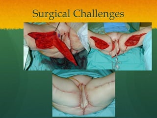 Surgical Challenges
 