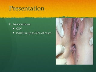 Presentation
 Associations
 CIN
 PAIN in up to 30% of cases
 
