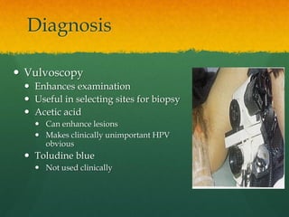 Diagnosis
 Vulvoscopy
 Enhances examination
 Useful in selecting sites for biopsy
 Acetic acid
 Can enhance lesions
 Makes clinically unimportant HPV
obvious
 Toludine blue
 Not used clinically
 