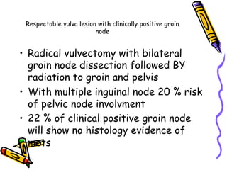 Respectable vulva lesion with clinically positive groin
node
•  Radical vulvectomy with bilateral
groin node dissection followed BY
radiation to groin and pelvis
•  With multiple inguinal node 20 % risk
of pelvic node involvment
•  22 % of clinical positive groin node
will show no histology evidence of
mets
 
