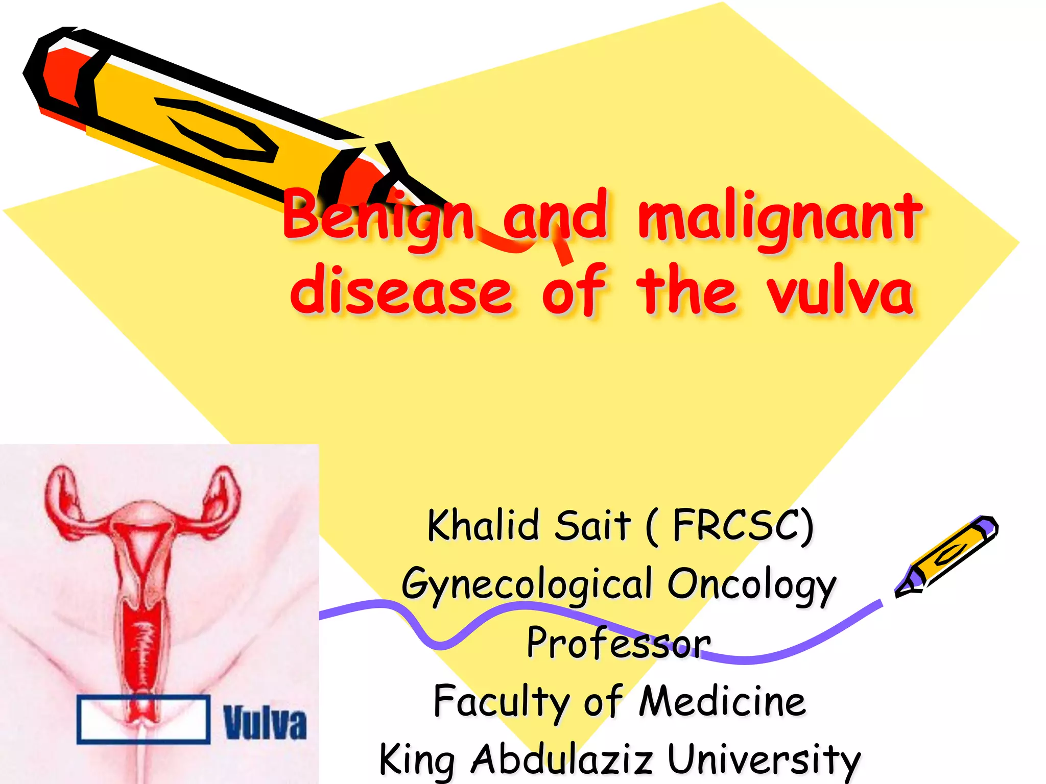 Benign and malignant
disease of the vulva
Khalid Sait ( FRCSC)
Gynecological Oncology
Professor
Faculty of Medicine
King Abdulaziz University