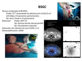 BSGC
Técnica combinada (S 90-95%)
PreQx: TC99 nanocoloide de albúmina 0,5 mCi/0,15 ml
(18 mBq) x 4 Inyecciones peritumorales.
Qx: Azul / Verde 2 ml peritumoral.
Detección: PreQx: SPET-TC
Qx: Gamma-Sonda manual portátil
Qx: Visualización colorante
Extracción: GC caliente y/o azul (>10%) 1 ó 2
Ultraestadificación: OSNA
 