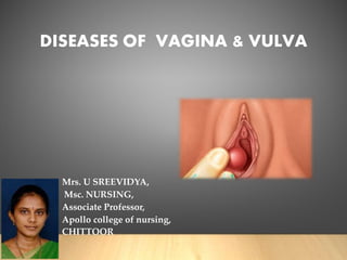 DISEASES OF VAGINA & VULVA
Mrs. U SREEVIDYA,
Msc. NURSING,
Associate Professor,
Apollo college of nursing,
CHITTOOR
 