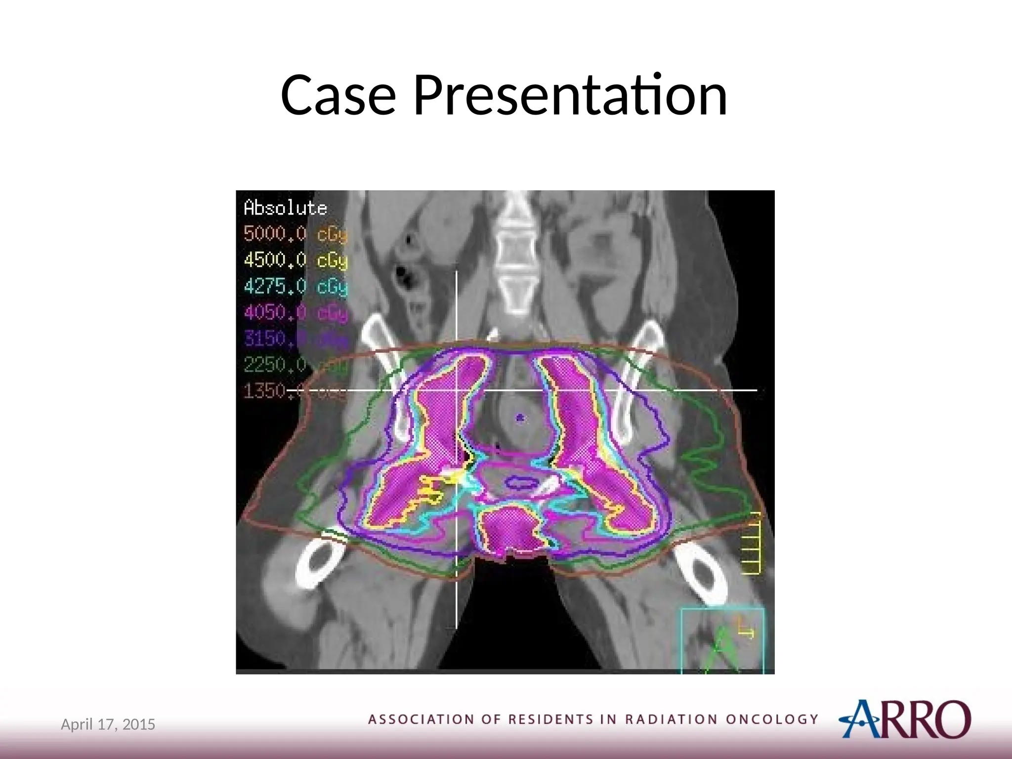 Case Presentation
April 17, 2015
 
