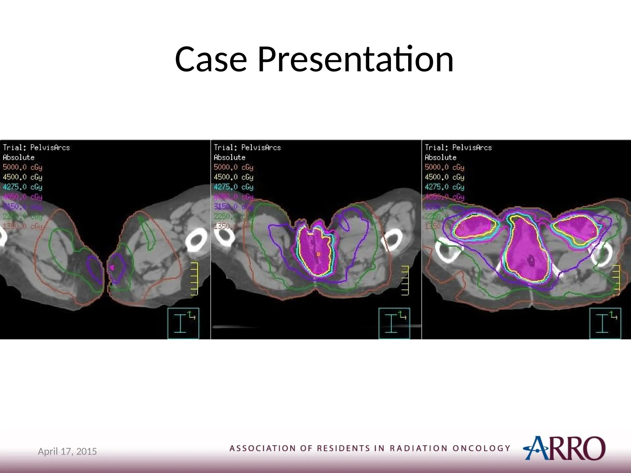 Case Presentation
April 17, 2015
 