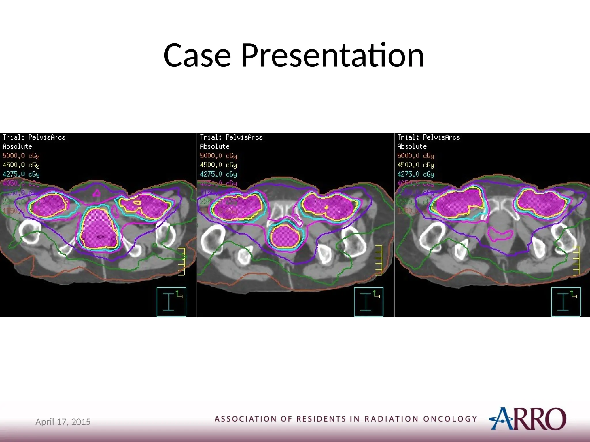 Case Presentation
April 17, 2015
 
