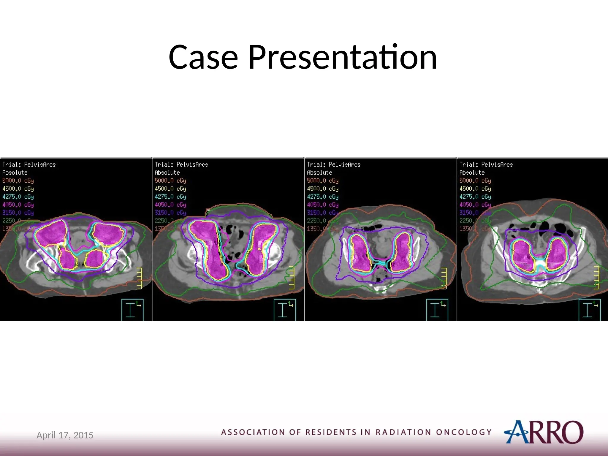 Case Presentation
April 17, 2015
 