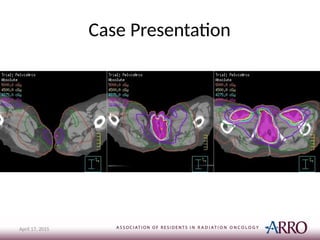 Case Presentation
April 17, 2015
 