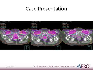 Case Presentation
April 17, 2015
 