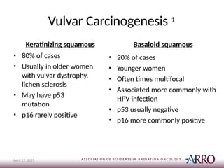 Vulvar Carcinogenesis 1
April 17, 2015
Keratinizing squamous
• 80% of cases
• Usually in older women
with vulvar dystrophy,
lichen sclerosis
• May have p53
mutation
• p16 rarely positive
Basaloid squamous
• 20% of cases
• Younger women
• Often times multifocal
• Associated more commonly with
HPV infection
• p53 usually negative
• p16 more commonly positive
 