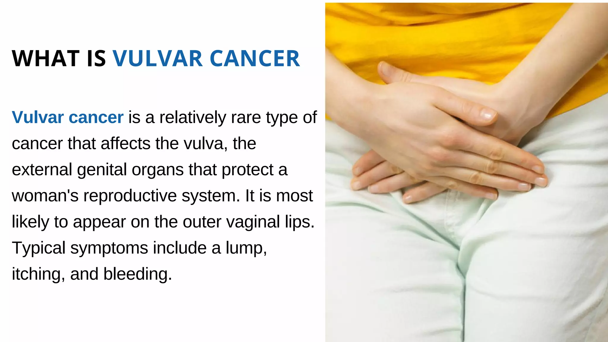 vulvar-cancer-north-texas-gynecologic-oncology-ppt