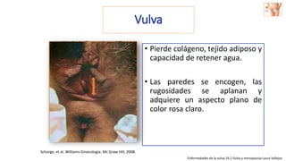 Vulva
• Pierde colágeno, tejido adiposo y
capacidad de retener agua.
• Las paredes se encogen, las
rugosidades se aplanan y
adquiere un aspecto plano de
color rosa claro.
Sin la influencia trófica
de los estrógenos…
Schorge, et al. Williams Ginecología. Mc Graw Hill, 2008.
Enfermedades de la vulva,19.2 Vulva y menopausia Laura Vallejos
 