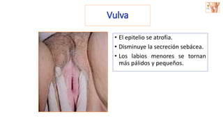 Vulva
• El epitelio se atrofia.
• Disminuye la secreción sebácea.
• Los labios menores se tornan
más pálidos y pequeños.
 