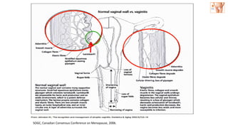 SOGC, Canadian Consensus Conference on Menopause, 2006.
 