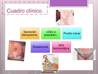Cuadro clínico.
Secreción
blanquecina.
«Olor a
pescado».
Prurito vulvar
Dispareunia
50%
Asintomática.
 