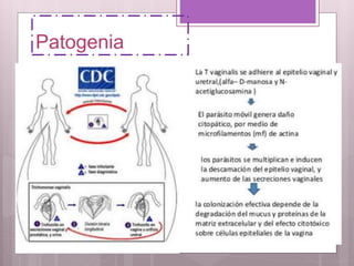 Patogenia
 