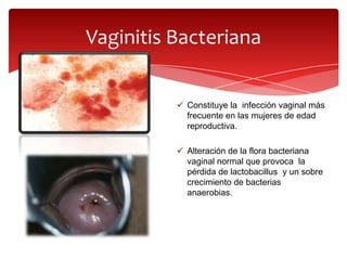 Vaginitis Bacteriana


           Constituye la infección vaginal más
            frecuente en las mujeres de edad
            reproductiva.

           Alteración de la flora bacteriana
            vaginal normal que provoca la
            pérdida de lactobacillus y un sobre
            crecimiento de bacterias
            anaerobias.
 