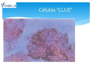 Células ‘CLUE’
 