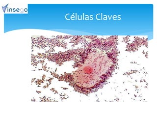 Células Claves
 