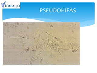 PSEUDOHIFAS
 