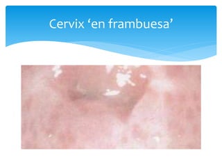Cervix ‘en frambuesa’
 