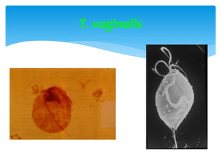 T. vaginalis
 