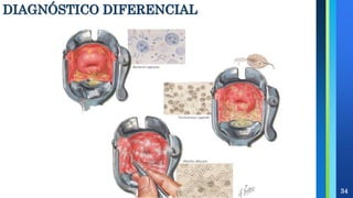 DIAGNÓSTICO DIFERENCIAL
34
 