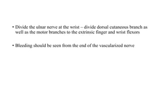 • Divide the ulnar nerve at the wrist – divide dorsal cutaneous branch as
well as the motor branches to the extrinsic finger and wrist flexors
• Bleeding should be seen from the end of the vascularized nerve
 