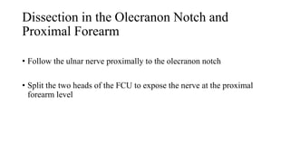 Dissection in the Olecranon Notch and
Proximal Forearm
• Follow the ulnar nerve proximally to the olecranon notch
• Split the two heads of the FCU to expose the nerve at the proximal
forearm level
 